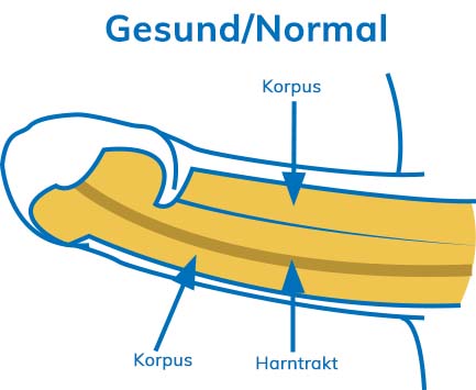 Diamgram: Healthy Penis