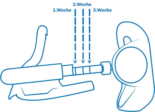 ProExtender Package